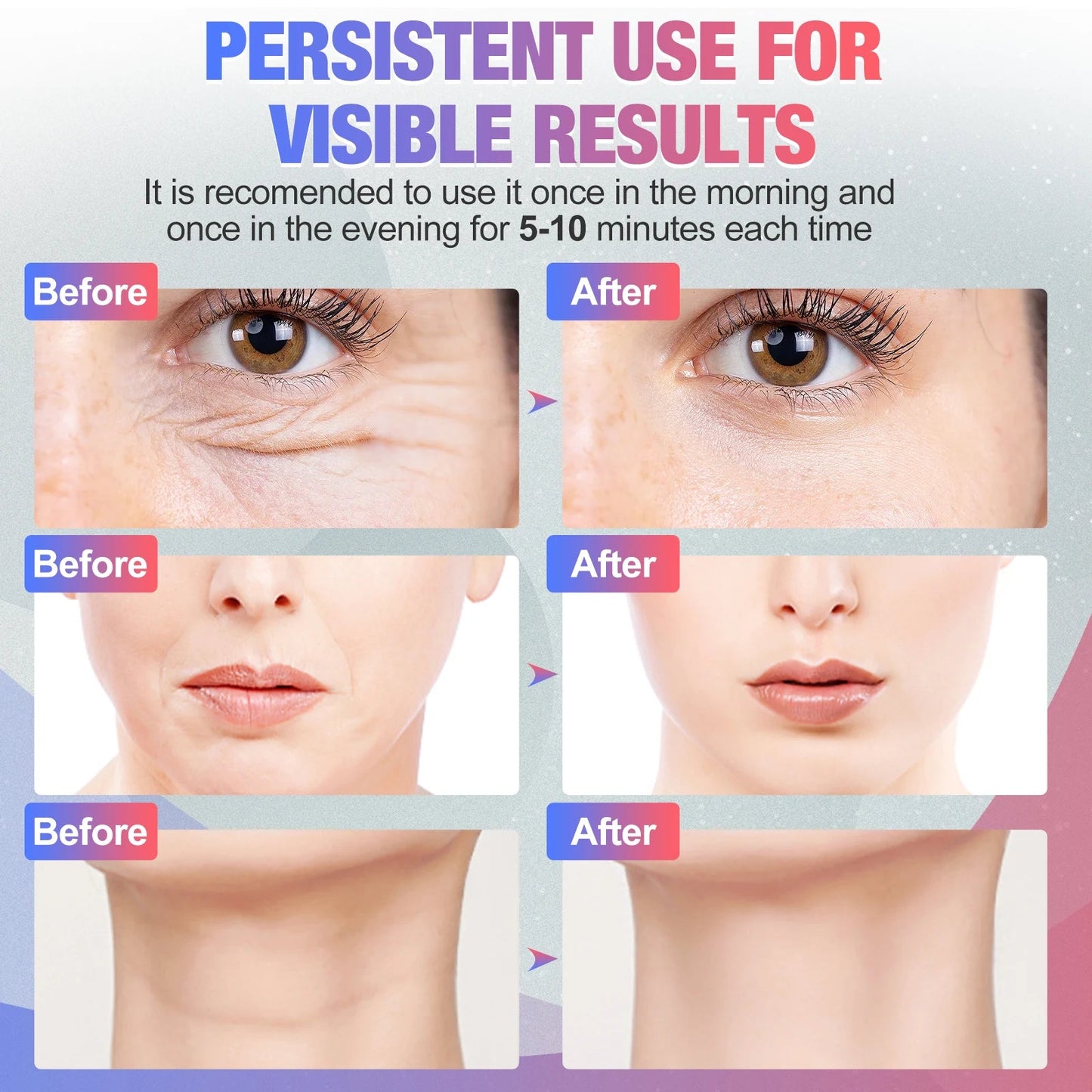 Neck Tightening Device - EMS Microcurrent Facial Massager & LED Light Therapy Sqin Med by Nurse Faye